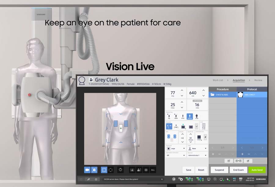 GC85A Vision Radiography Room | Samsung Healthcare